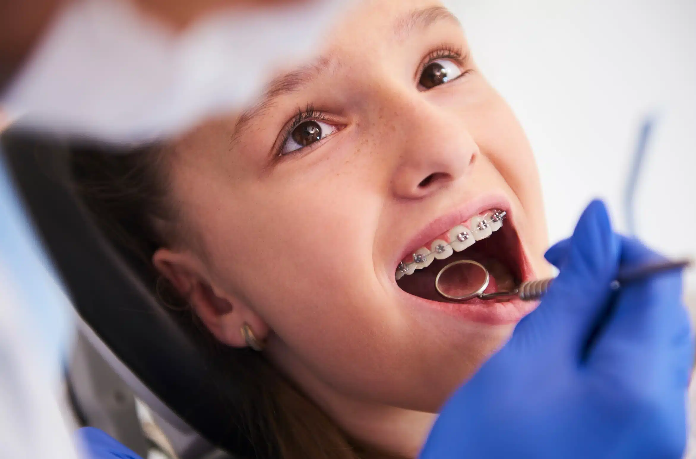 Metal Braces: Does This Traditional Dental Technology Have a Future?